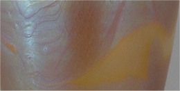 loetz franz hofstotter 2 details_3